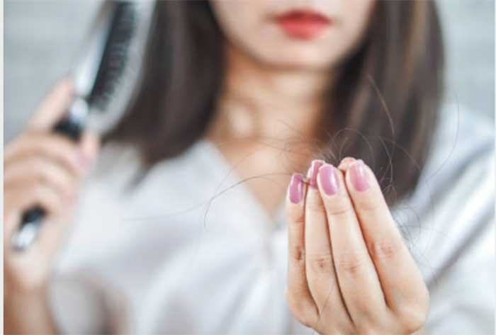Ilustrasi rambut rontok
