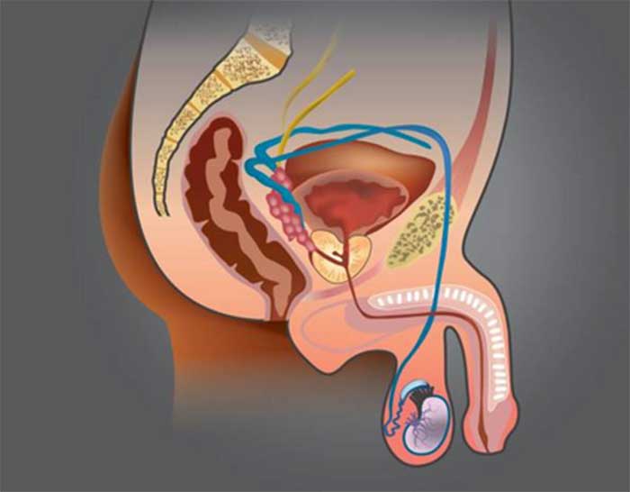 Ilustrasi pengangkatan testis, tindakan ini umumnya dilakukan sebagai langkah terakhir untuk mengatasi kondisi medis yang mengancam jiwa.