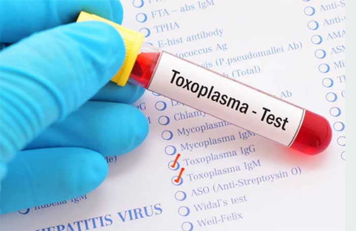 Gejala awal toxoplasma gondii dapat berupa flu, demam, sakit kepala, nyeri pada sekujur tubuh, dan sakit tenggorokan.