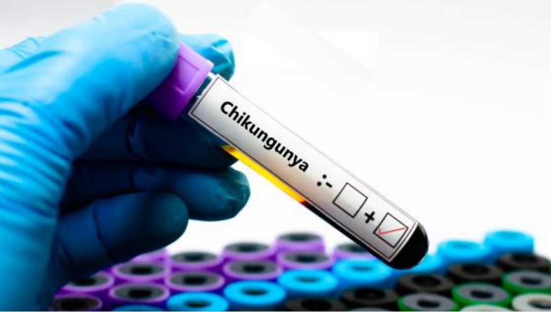 Chikungunya ditularkan melalui gigitan nyamuk Aedes aegypti dan Aedes albopictus.