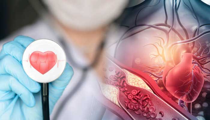 Penting untuk memahami perbedaan hipertensi dan kolesterol tinggi agar bisa mengambil langkah yang tepat.