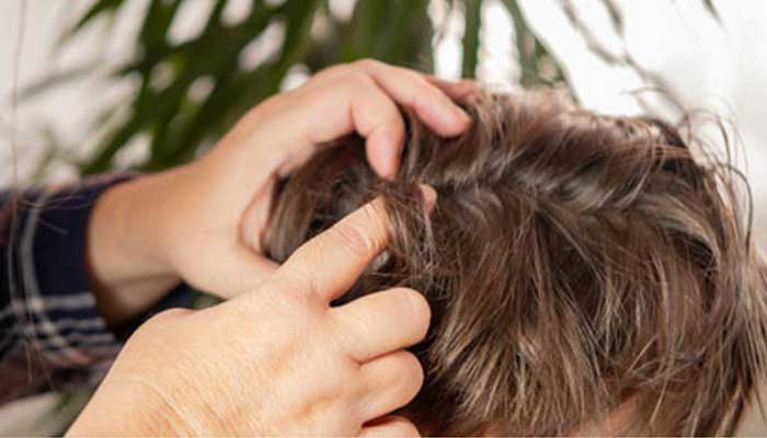 Petan, tradisi cari kutu nenek moyang yang nilai sosialnya masih relevan hingga saat ini. Foto adalah ilustrasi.