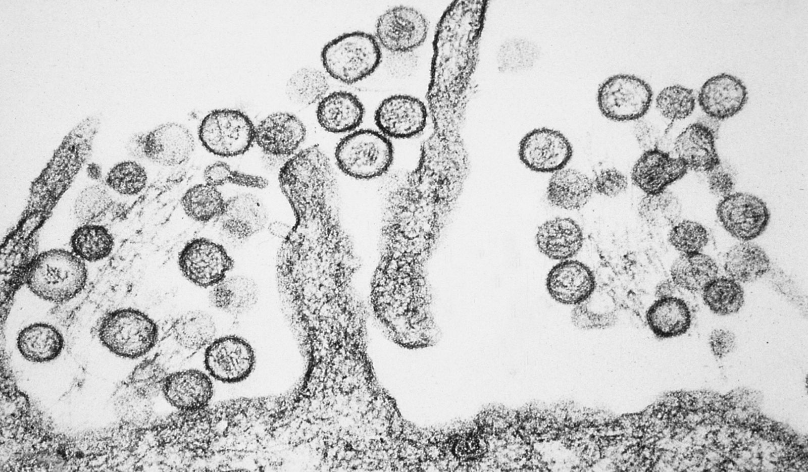 Ilustrasi Hanta VIrus