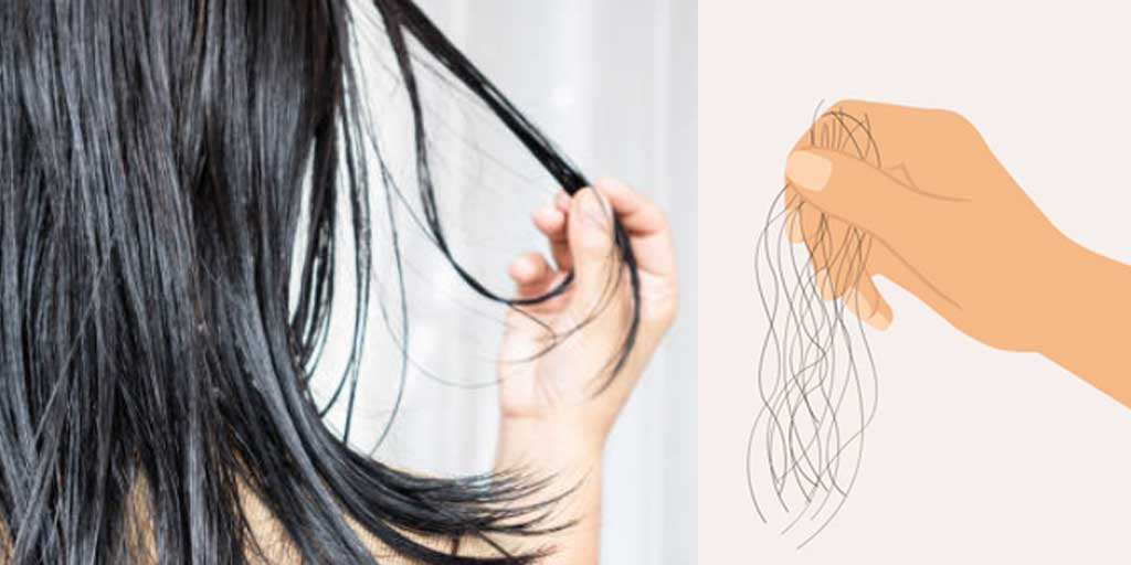 Ada beberapa tips simple untuk rambut kusut, kering, gampang rontok, dan lepek. Foto adalah ilustrasi.