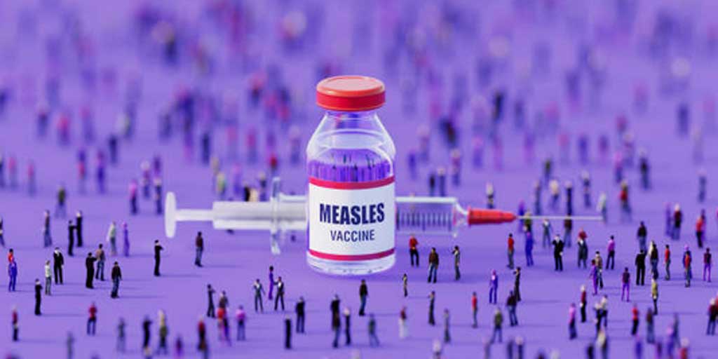 49 warga di Tuban terduga (suspect) campak, dan dua orang diantaranya dinyatakan positif terinfeksi virus measles penyebab campak. Foto adalah ilustrasi.