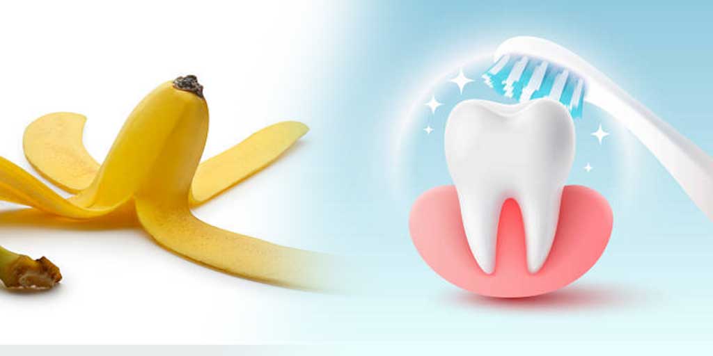 Apakah kulit pisang bisa memutihkan gigi? Ada beberapa penjelasan sekaligus manfaat dan cara menggunakannya.