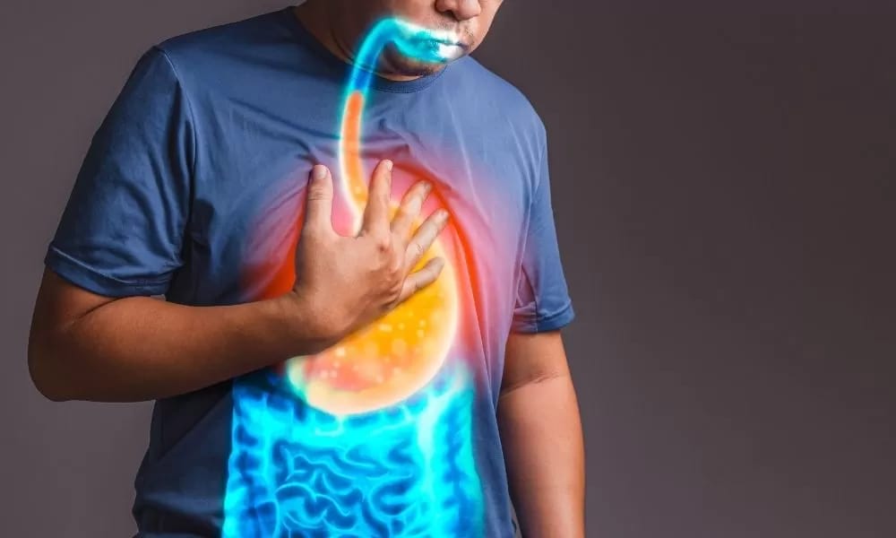 Bukan mitos, puasa bisa bantu redakan GERD asal pola makan terjaga dan stres terkendali. Konsultasi dokter tetap disarankan.