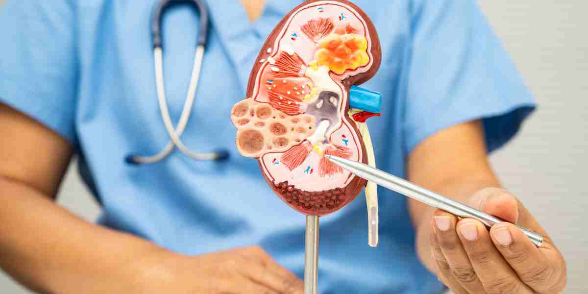 Dokter menjelaskan jenis kanker ginjal yang paling sering menyerang orang dewasa adalah renal cell carcinoma yang dipicu berbagai faktor risiko.