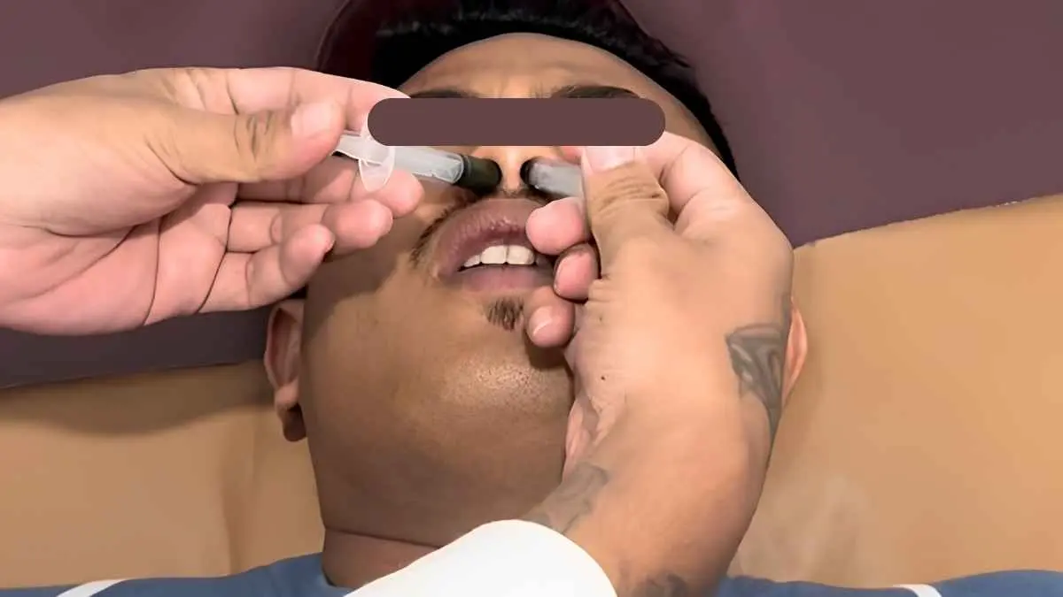 Masih banyak yang percaya gurah bisa menyembuhkan sinusitis. Tapi benarkah cara tradisional ini sudah terbukti secara medis? Sebelum mencoba, ketahui dulu manfaat, risiko, hingga efek samping yang mungkin terjadi. (ilustrasi gurah)