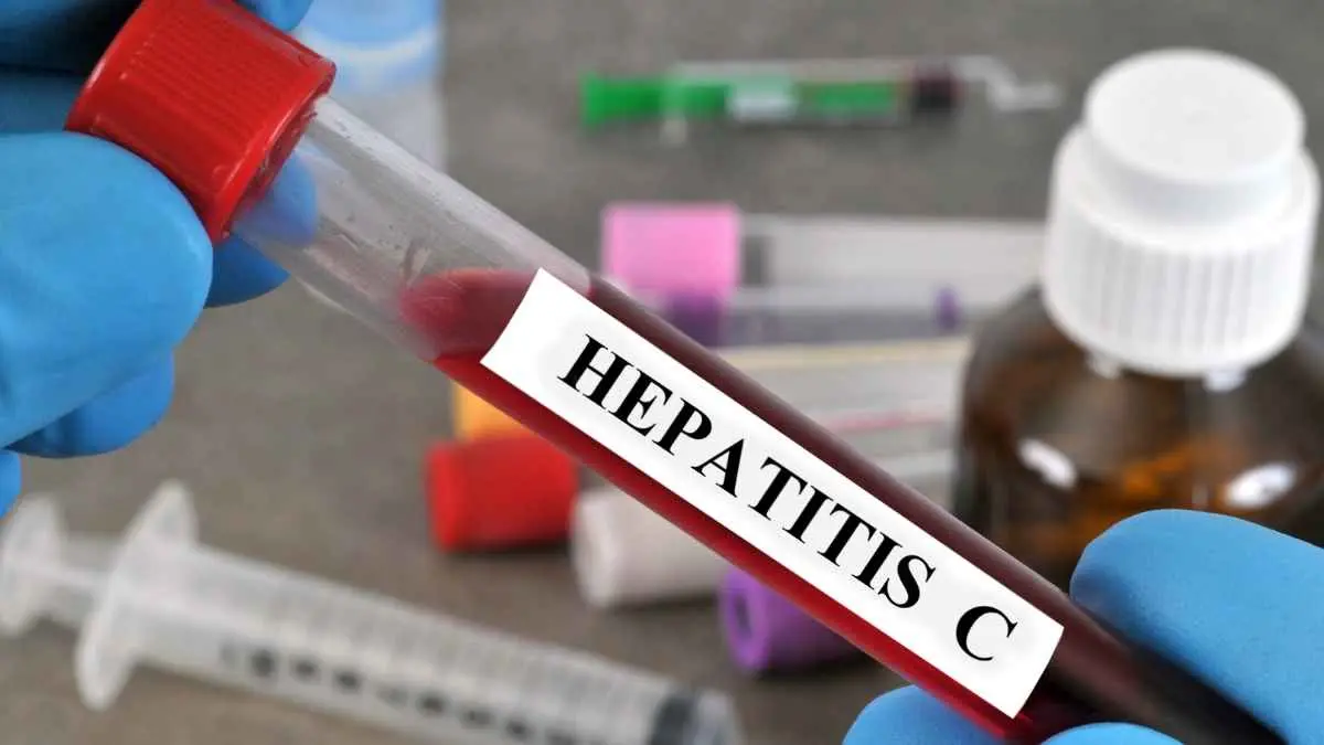 Inggris selangkah lagi mencetak sejarah: hepatitis C mulai berhasil ditekan, bahkan 84,6 persen kasus yang diketahui sudah mendapat pengobatan. (ilustrasi)