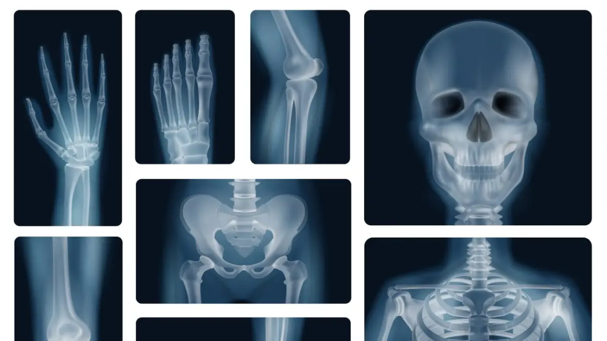 X-Ray tulang manusia. (Magnific)