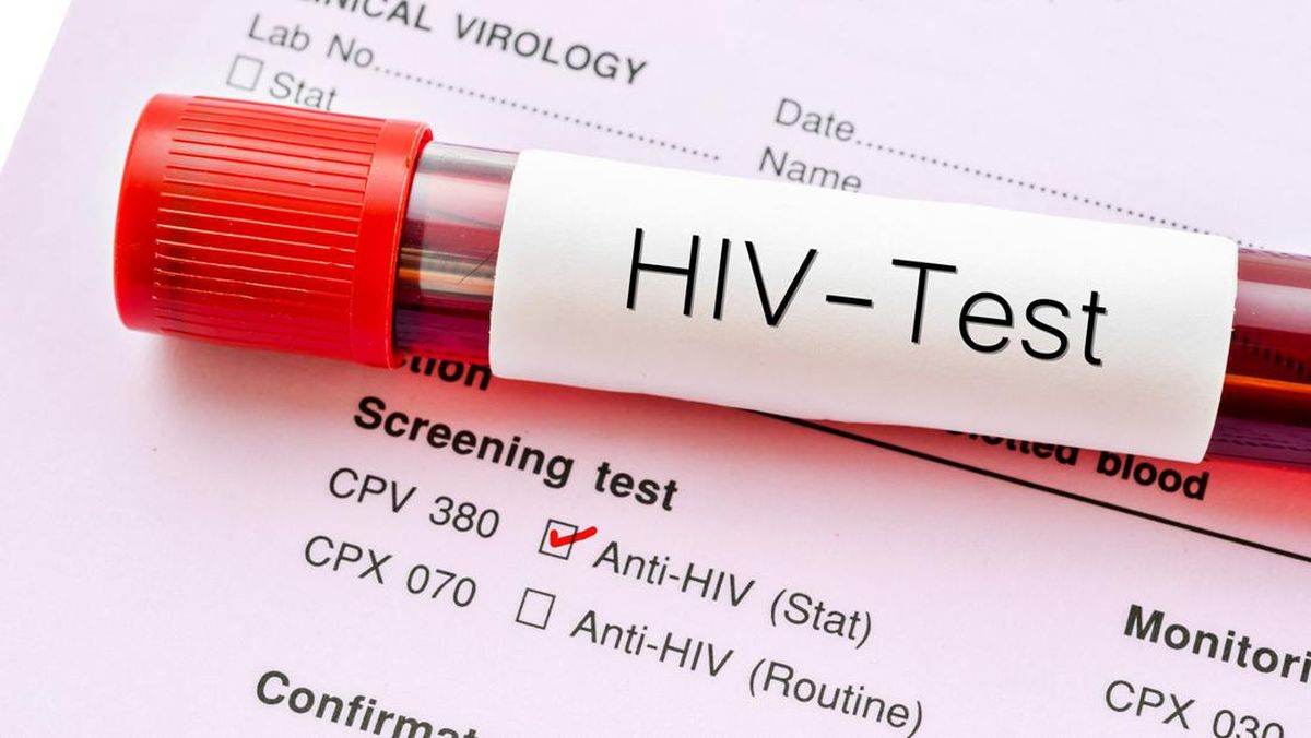 Ilustrasi tes HIV.
