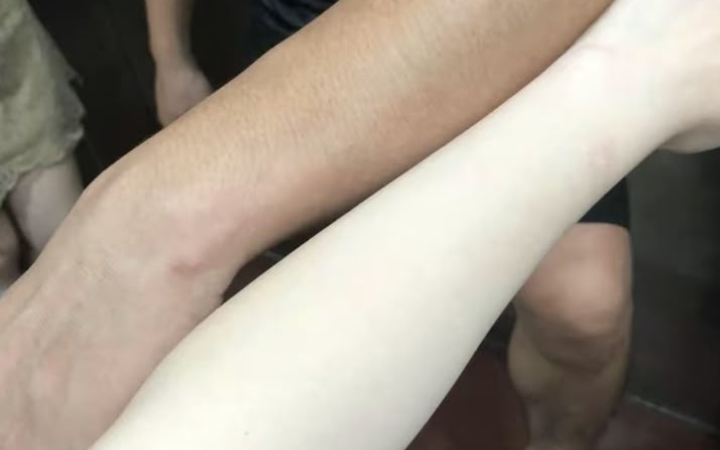 Banyak orang beranggapan bahwa cukup memakai sabun dan lotion, kulit akan tetap sehat. Padahal masih butuh perawatan lain.