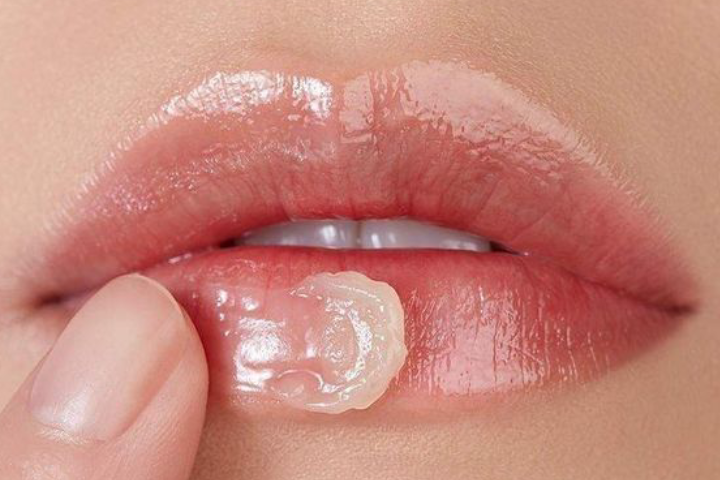 Bibir juga rentan terkena dampak sinar matahari, bukan hanya wajah. Simak tips perlindungannya.
