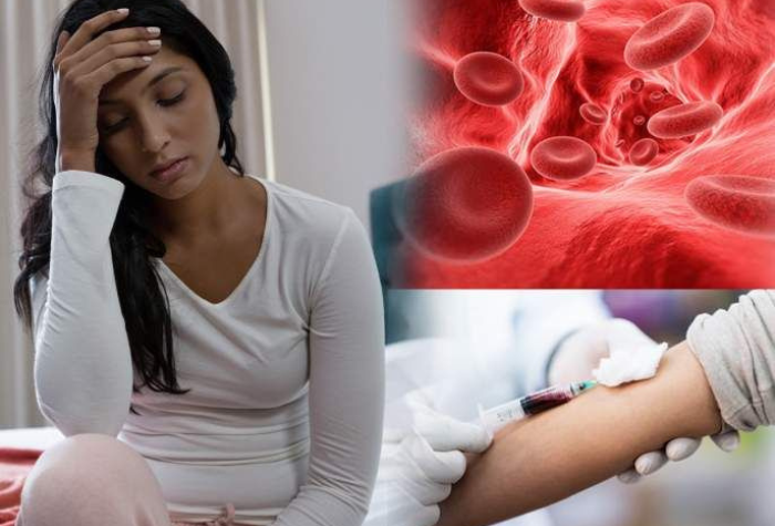 Anemia adalah kondisi kekurangan sel darah merah yang menyebabkan tubuh mudah lelah dan lemas, namun dapat dicegah dengan pola makan bergizi.