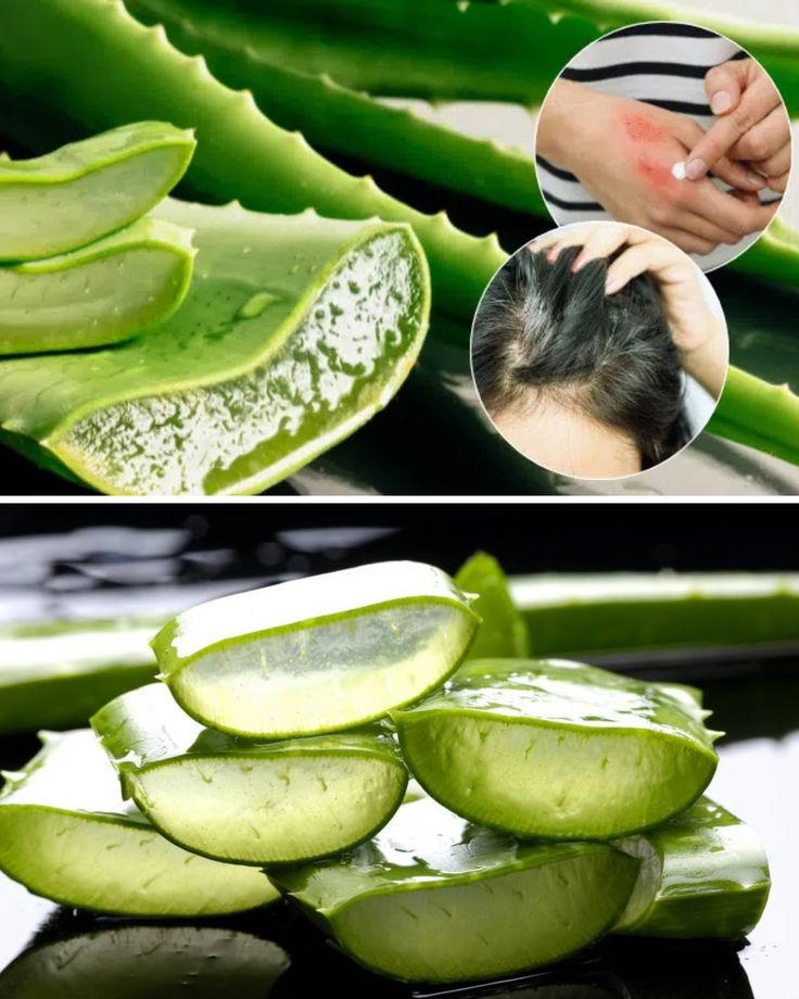Cantik tak selalu mahal, cukup rawat diri dengan lidah buaya dari alam.