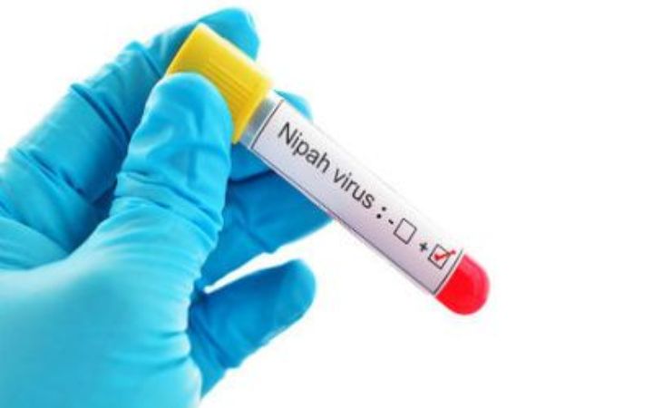 Virus Nipah, penyakit zoonosis mematikan yang ditularkan dari kelelawar ke manusia dan memiliki tingkat kematian hingga 91 persen.