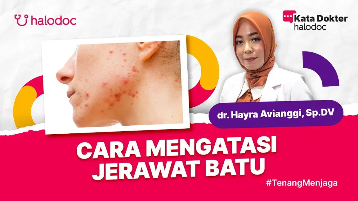 Penyebab Jerawat Batu ternyata dipicu bakteri dan hormon! Ketahui ciri-ciri, cara mengobati medis ke dokter, serta pantangan perawatannya di sini.