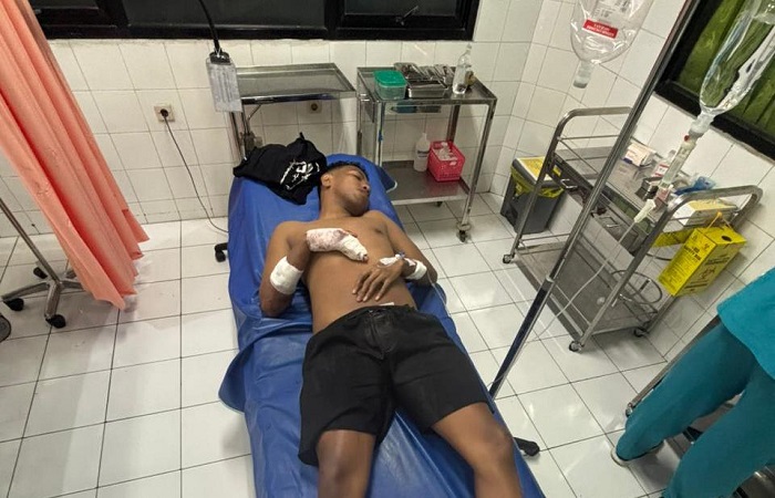 Kristianus Bayu AP Soares, 24, terbaring lemas di RSAD Denpasar, Kamis (1/01/2026) lalu. Ia diserang pakai tombak saat malam pergantian tahun.