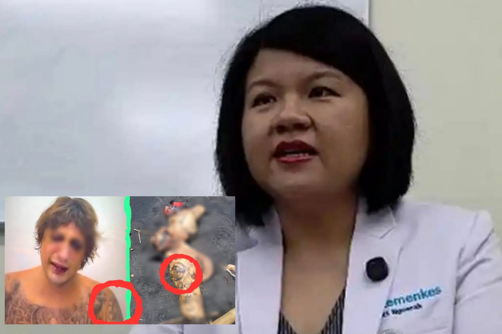 Hasil pemeriksaan awal tim forensik RSUP Prof Dr IGNG Ngoerah menunjukkan korban telah meninggal sekitar tiga hari sebelum ditemukan. 