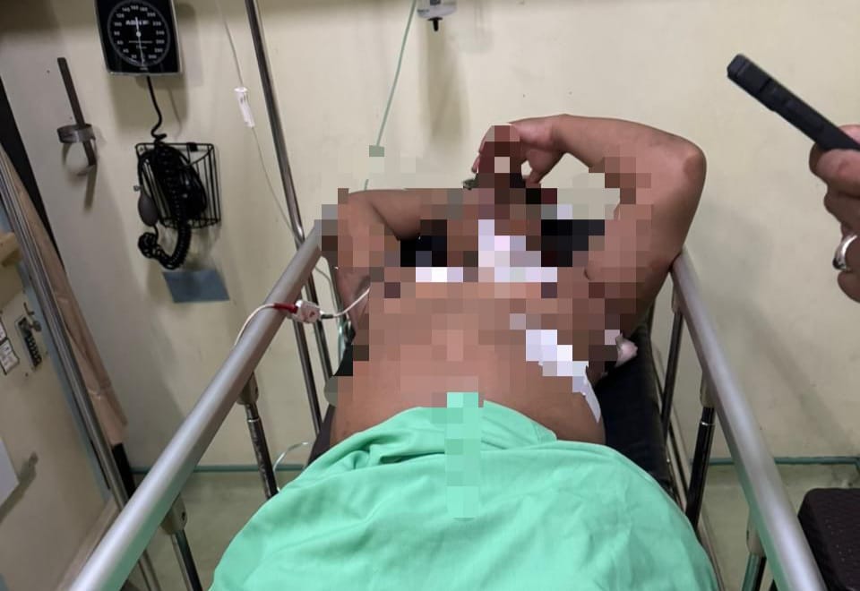 I Made Dwipa A, 42, mengalami beberapa luka tusuk serius setelah diserang oleh rekannya, I Dewa Gede Surya M, 30, diduga dipicu perselisihan saat membicarakan rencana gadai BPKB sepeda motor.
