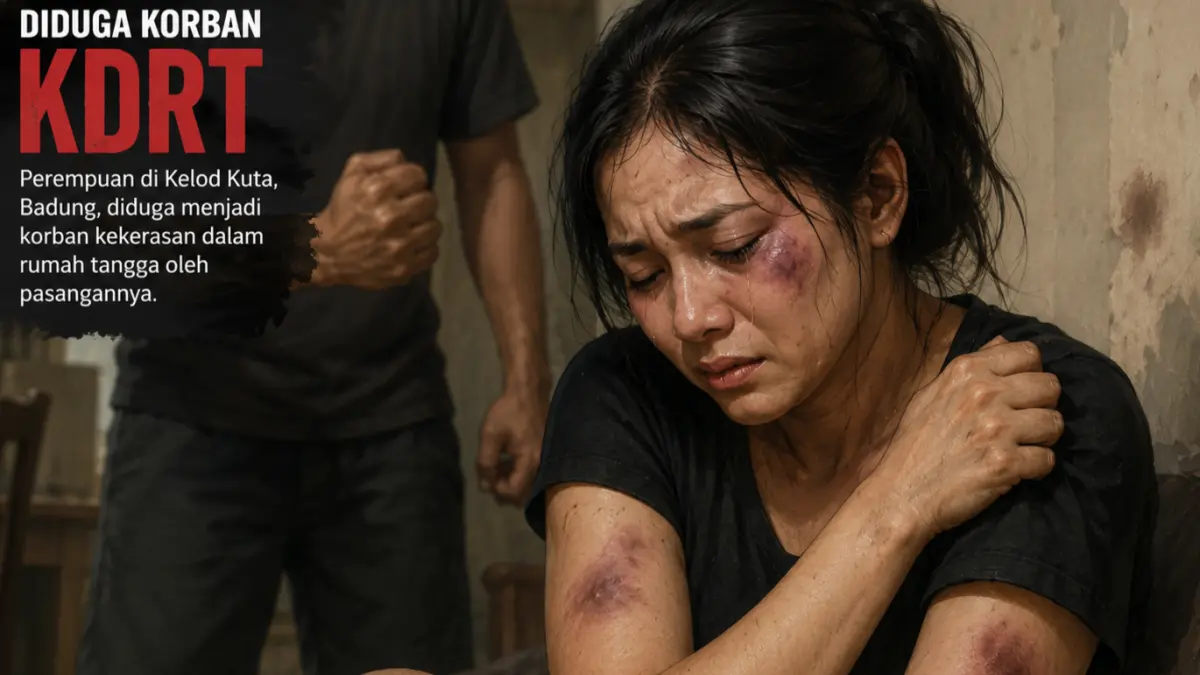 Seorang perempuan diduga menjadi korban kekerasan dalam rumah tangga (KDRT) dengan luka memar di sejumlah bagian tubuh, akibat dugaan penganiayaan pasangannya di kawasan Kelod Kuta, Badung. (Ai) 