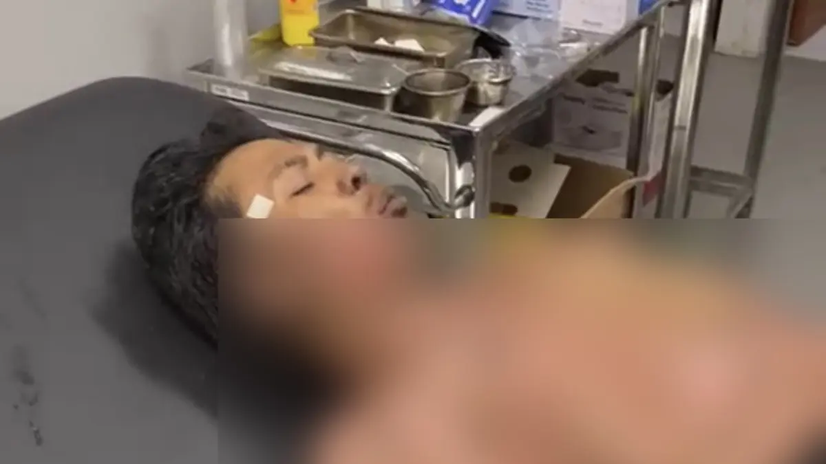 Sopir truk asal Banjar Susut, Desa Muncan, Karangasem, I Gede Slamet, 20, dibakar bosnya, Jumat siang (18/9). (IST)