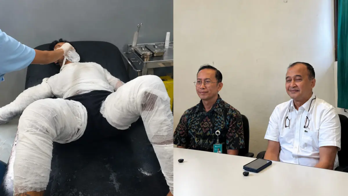 I Gede Selamat, sopir truk yang dibakar bosnya di Karangasem masih sekarat. (IST/ Ni Kadek Novi Febriari)