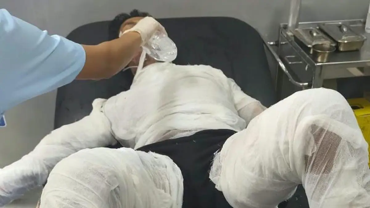 I Gede Selamet saat dalam perawatan di RSUP Prof Ngoerah, Denpasar. Sopir truk yang dibakar bosnya ini akhirnya meninggal dunia. (IST)