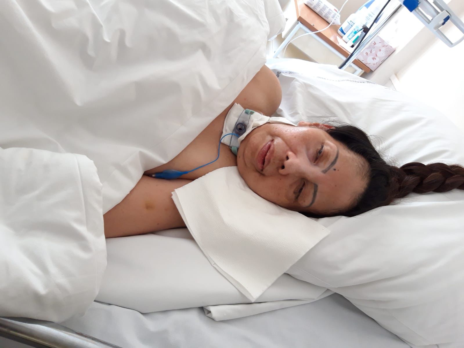 SAKIT: Kondisi PMI asal Indonesia Agus Listianingsih yang masih tergolek lemah di RS Bydgoszcz, Polandia.