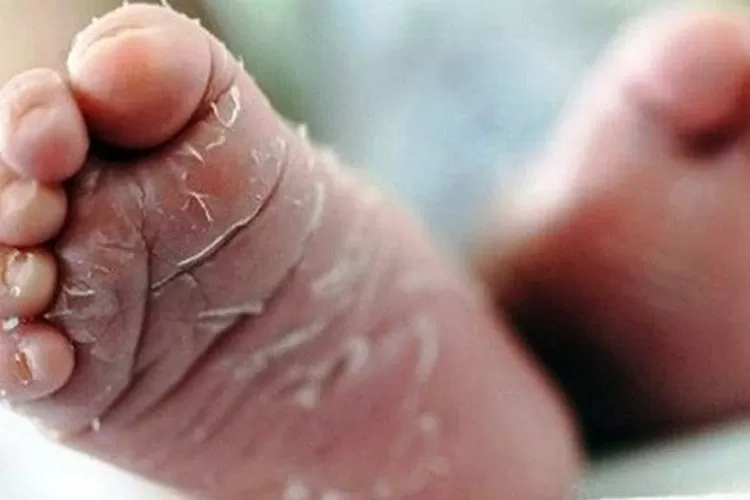 BELUM TERUNGKAP: Penemuan bayi hidup di TPST Kertalangu namun meninggal di rumah sakit, pelaalkunya belum terungkap.