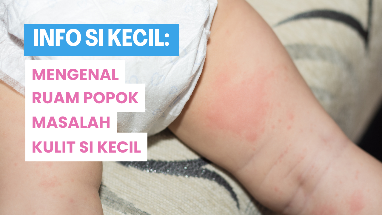 MASALAH PADA BAYI: Ilustrasi ruam popok dan cara menceganya pada bayi.