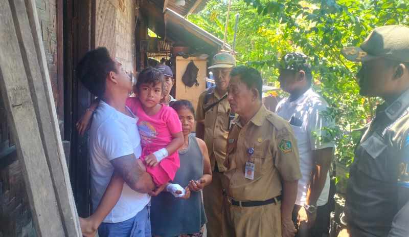 KUNJUNGI KORBAN : Pelaksana Tugas (Plt) Kadis Pertanian dan Pangan Jembrana I Gusti Ngurah Sumber Wijaya, menjenguk korban gigitan anjing diduga rabies. (foto: dinas pertanian jembrana)