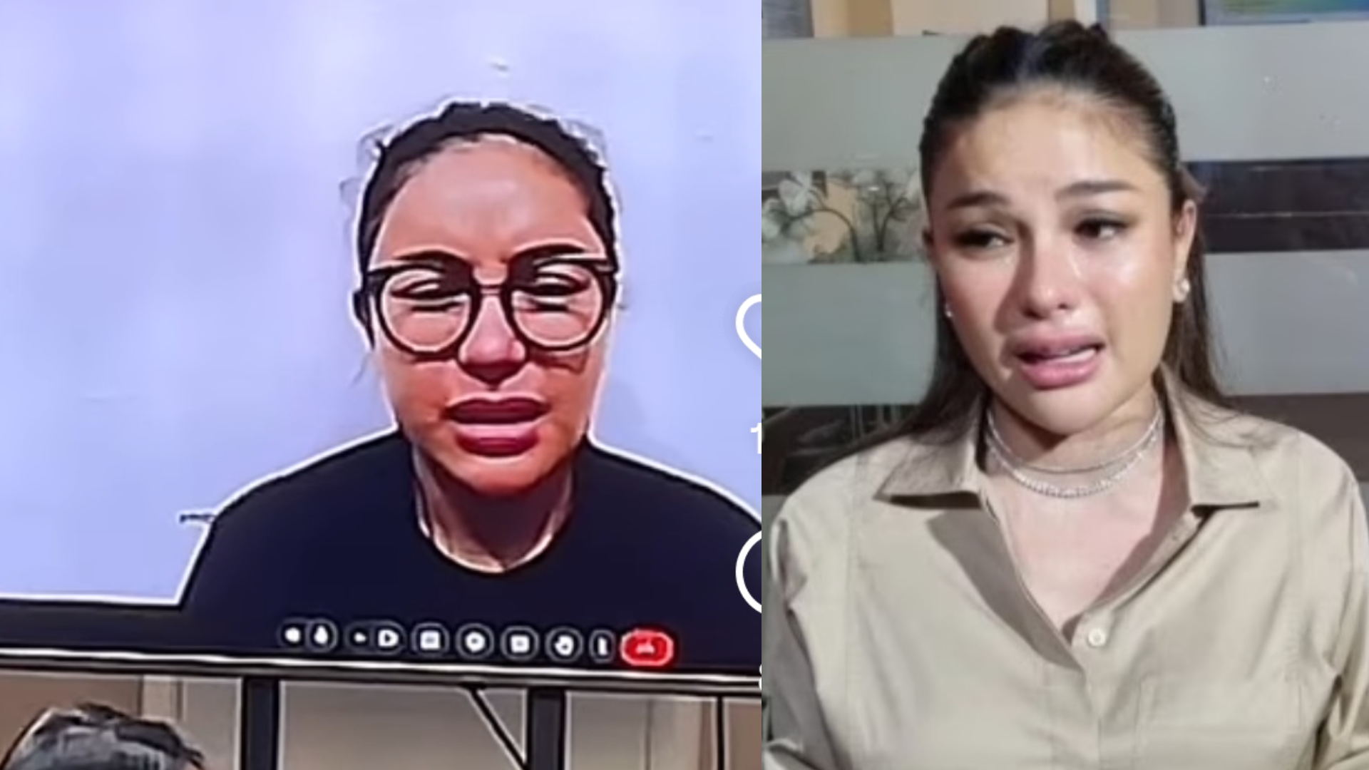 Nikita Mirzani sakit akibat implan di wajah pecah