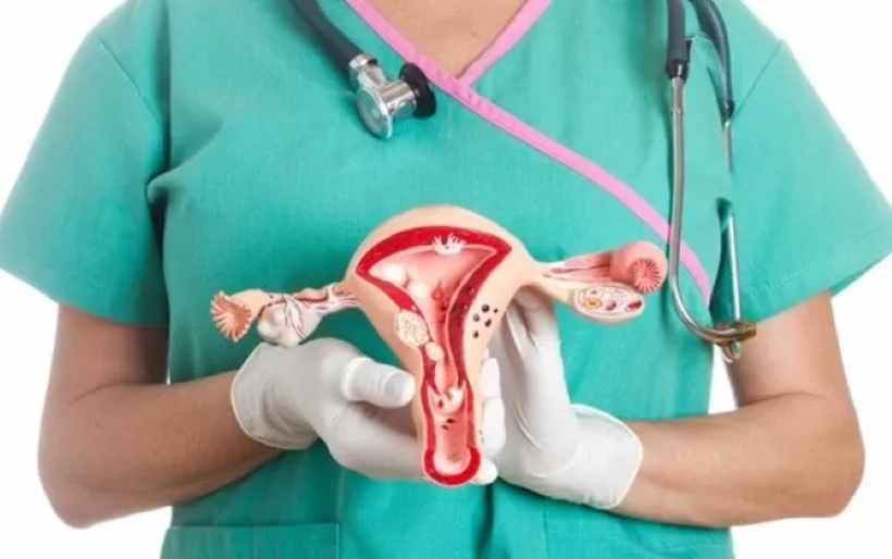 Ilustrasi kanker serviks. (Jawa Pos.com)