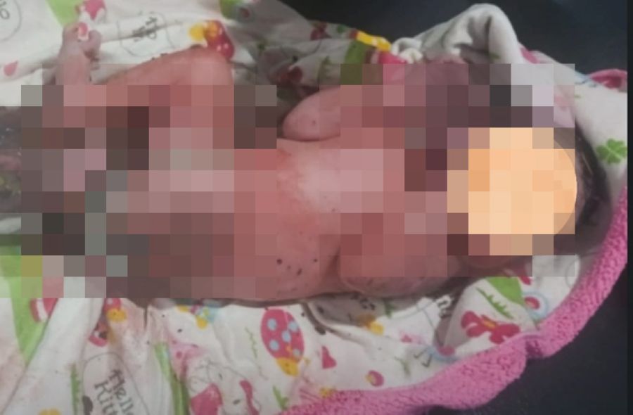 MENANGIS: Bayi yang baru lahir ditemukan di belakang kandang sapi Lingkungan Menesa Desa Adat Kampial, Kelurahan Benoa, Kecamatan Kuta Selatan, Badung, Senin 15 Desember 2025