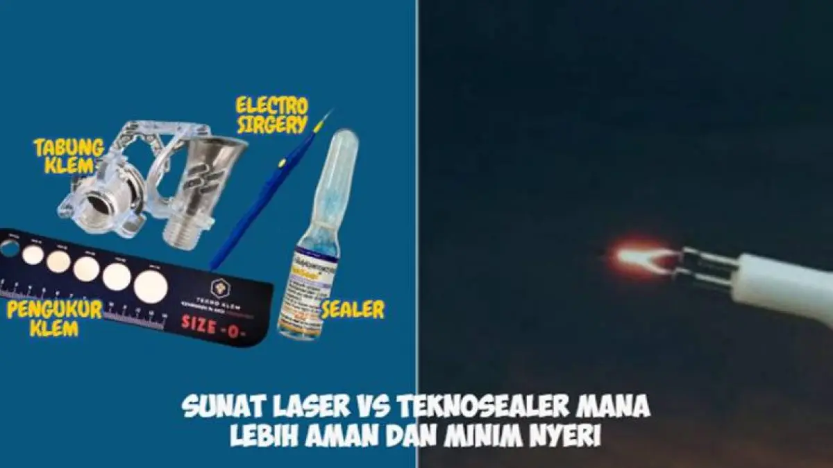 Metode teknosealer kini mulai menjadi perhatian karena menawarkan pendekatan yang lebih modern dibandingkan metode sebelumnya.
