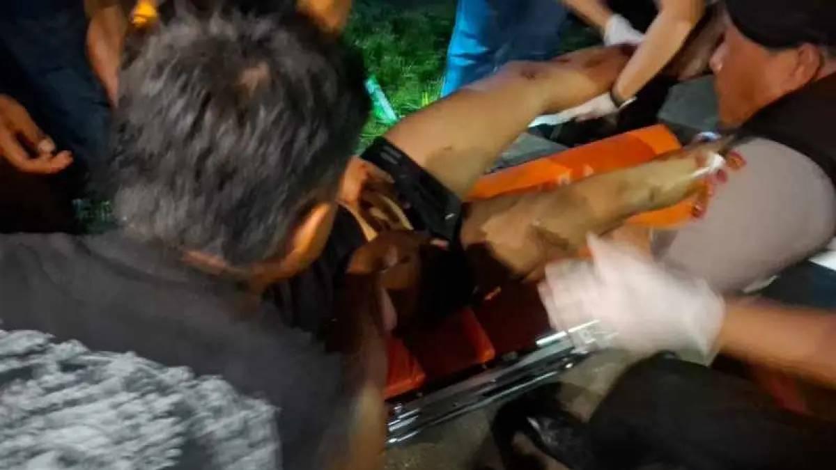 KINI MAKIN KRITIS : Kondisi pelaku begal paha kecelakaan seusai beraksi. (Polres Jembrana)
