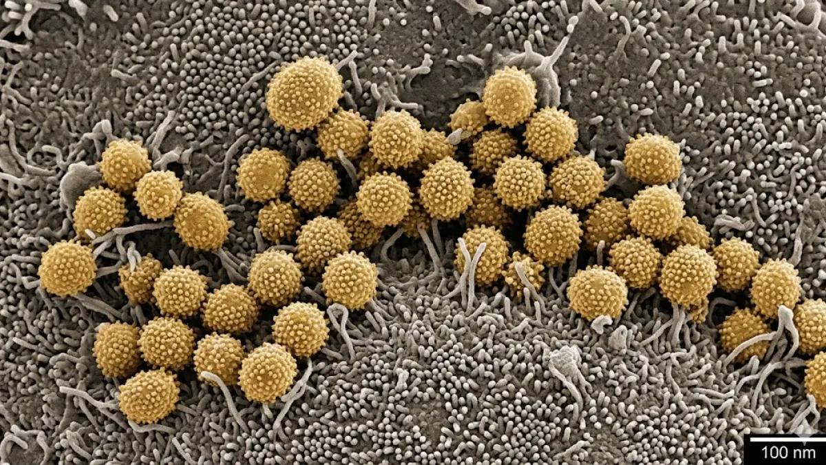 Orthohantavirus yang ditularkan dari hewan ke manusia dengan hewan pengerat seperti tikus atau kelelawar sebagai inang utama. 