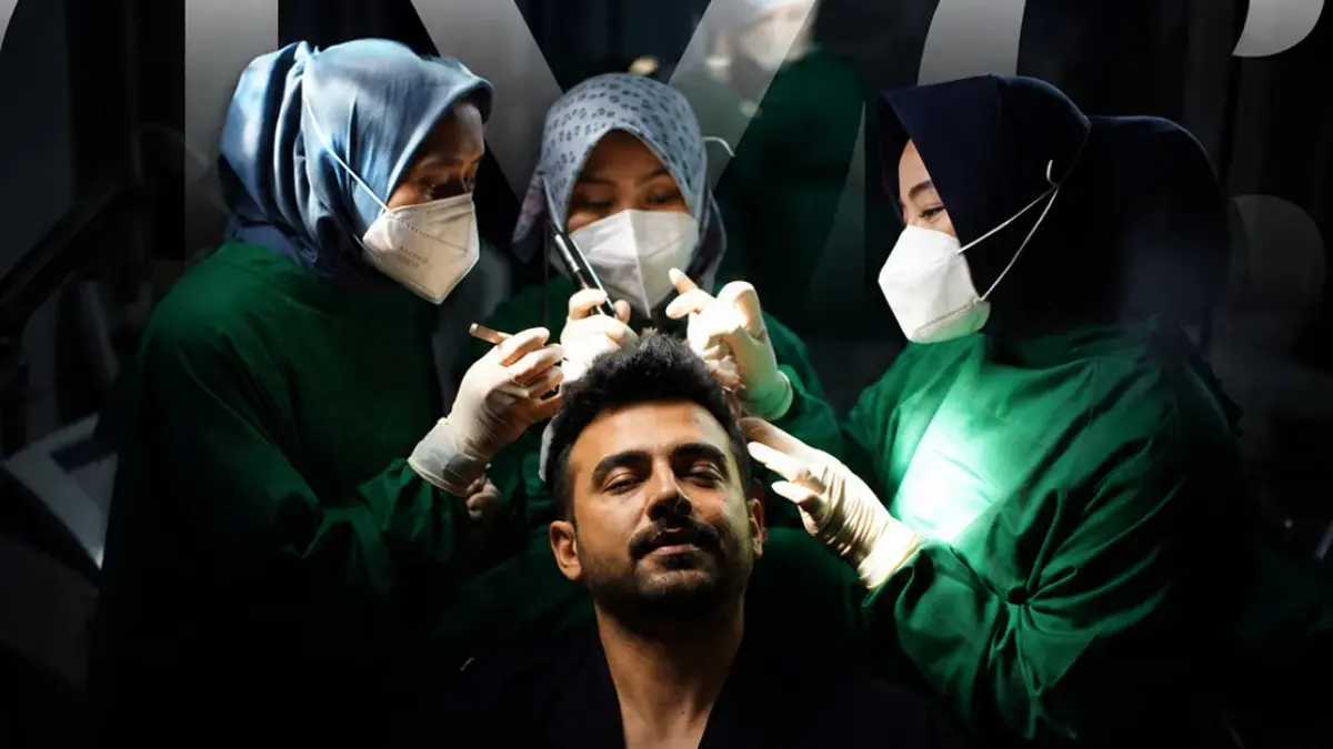 Bagi banyak pria yang mengalami kerontokan atau kebotakan, transplantasi rambut menjadi salah satu solusi yang menarik.