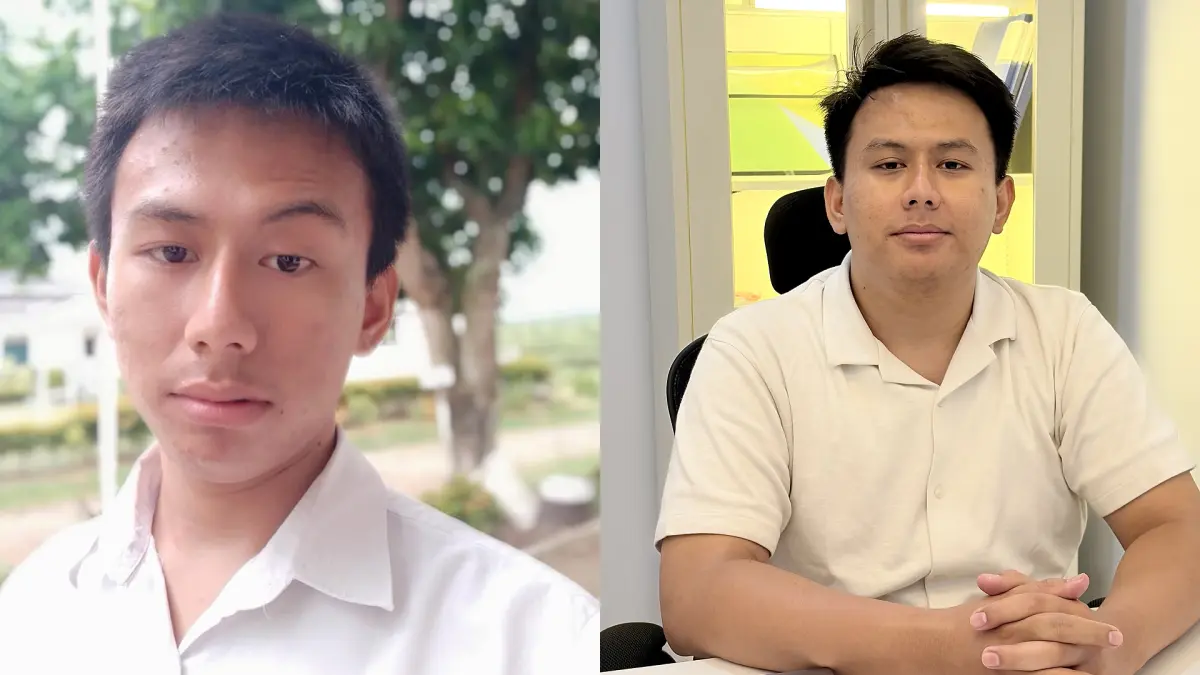 Before After: Kadek Krisna Dewa Anggana