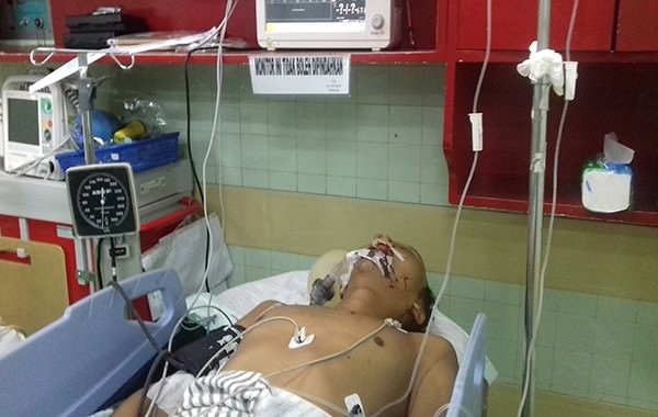 diseruduk-mobil-jadi-korban-tabrak-lari-nelayan-jembarana-sekarat