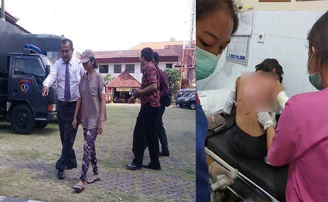 omggara-gara-gunting-hilang-prt-di-gianyar-disiram-air-panas-majikan