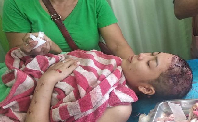 buru-driver-ojol-penganiaya-cewek-karangasem-polisi-lakukan-cara-ini