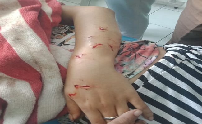 ngeri-begini-hasil-visum-korban-peganiayaan-driver-ojol-di-rsad