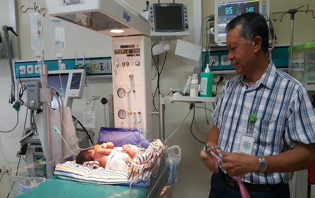 bayi-kembar-siam-lahir-di-buleleng-tim-dokter-rujuk-ke-rsup-sanglah