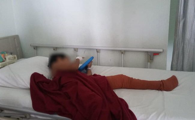 fakta-baru-psm-bocah-yang-dipukuli-ayah-kandung-hingga-patah-tulang
