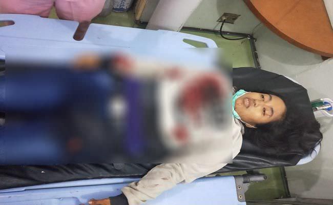 update-ibu-ibu-ditusuk-di-pasar-kreneng-pande-pelaku-suami-korban
