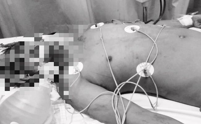 fakta-baru-mendiang-degdeg-diduga-jadi-korban-salah-sasaran