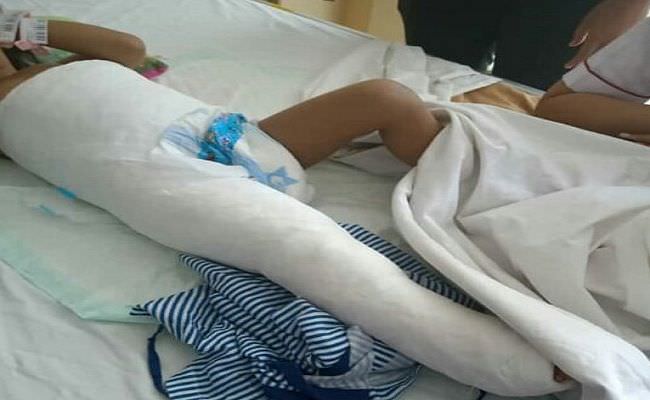 lancar-jalani-operasi-pasang-gips-tiga-hari-lagi-bisa-pulang-dari-rs
